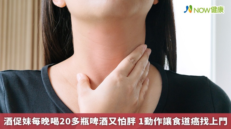 酒促妹每晚喝20多瓶啤酒又怕胖　1動作讓食道癌找上門