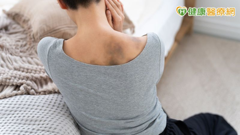 車禍傷口癒合竟變蟹足腫!醫:除疤先分型