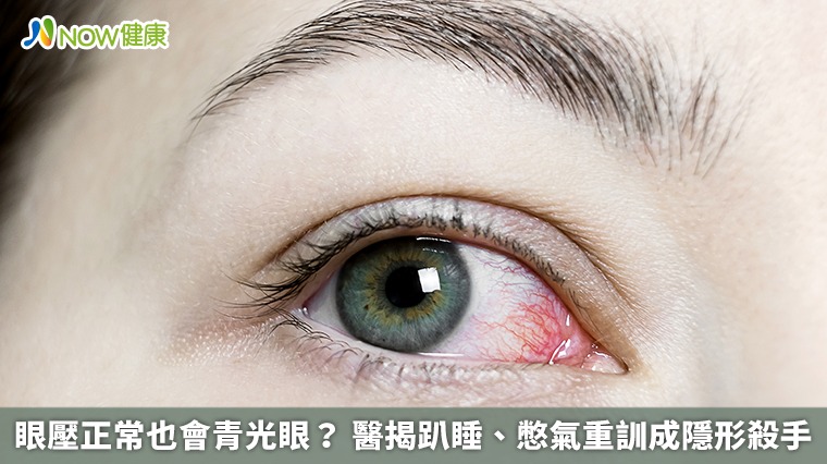 眼壓正常也會青光眼? 醫揭趴睡、憋氣重訓成隱形殺手