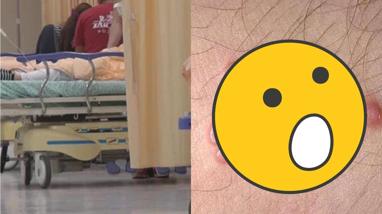 小孩皮膚突冒小珍珠！癢到崩潰「一抓秒長一排」醫揭1原因：病毒狂開分店