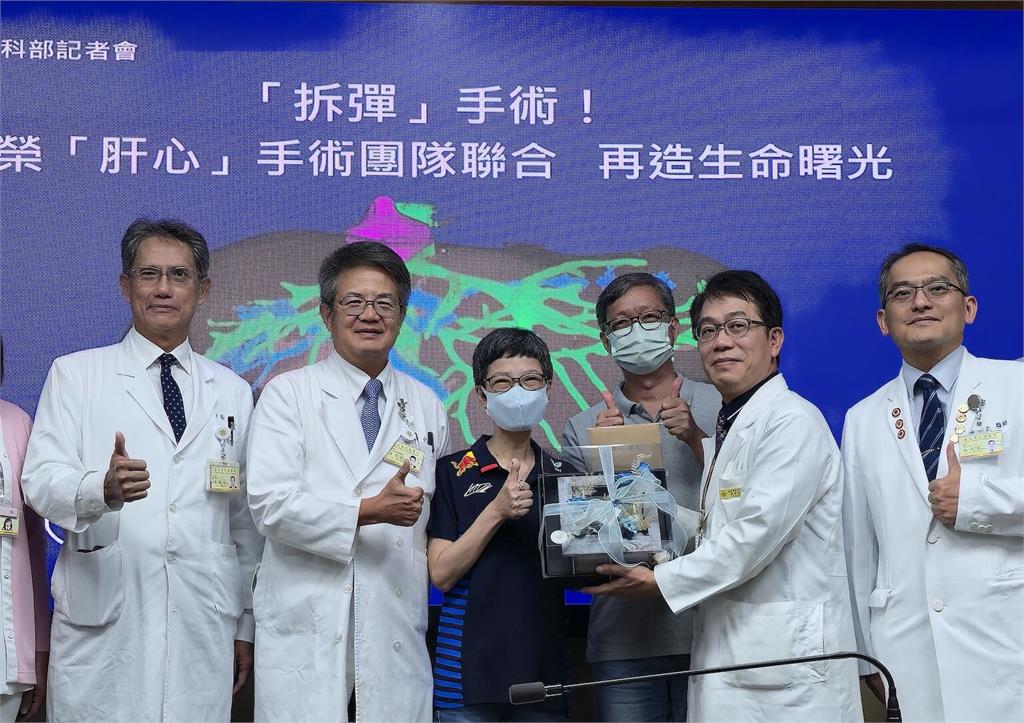 「惡瘤緊扒肝臟和心臟」   北榮完成不可能挑戰！取肝清除重新植回