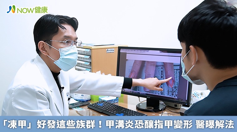 「凍甲」好發這些族群！甲溝炎恐釀指甲變形　醫曝解法