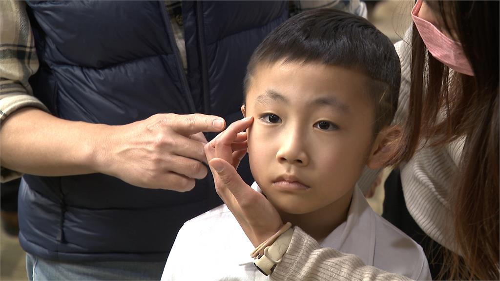 男童右臉凸出罹罕見惡瘤！　「3D人骨拼圖」救命不留疤