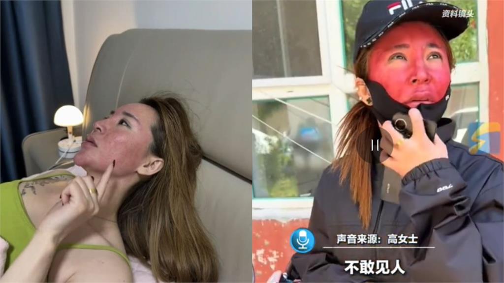 中國狂女22年來「從不卸妝」！臉部紅腫成硬塊「變成關公」超慘畫面曝