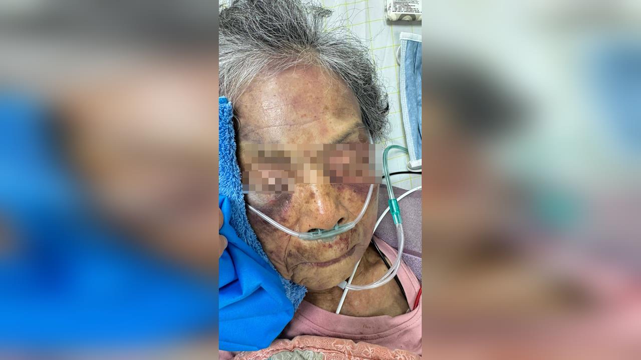 快新聞／90歲也打得下去？屏東37歲逆孫狂毆嬤　家人怒罵「畜生」