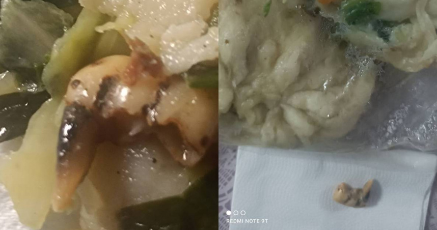 台東水煎包「內餡驚見牙齒」！牙醫證實為人類假牙　網友曝內幕