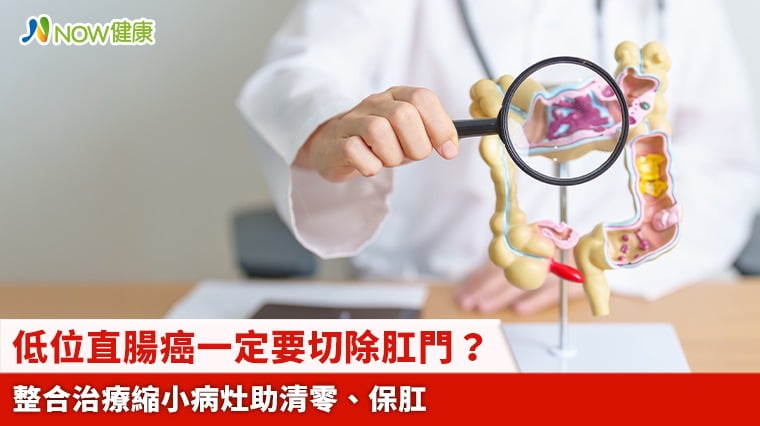 低位直腸癌一定要切除肛門？ 整合治療縮小病灶助清零、保肛