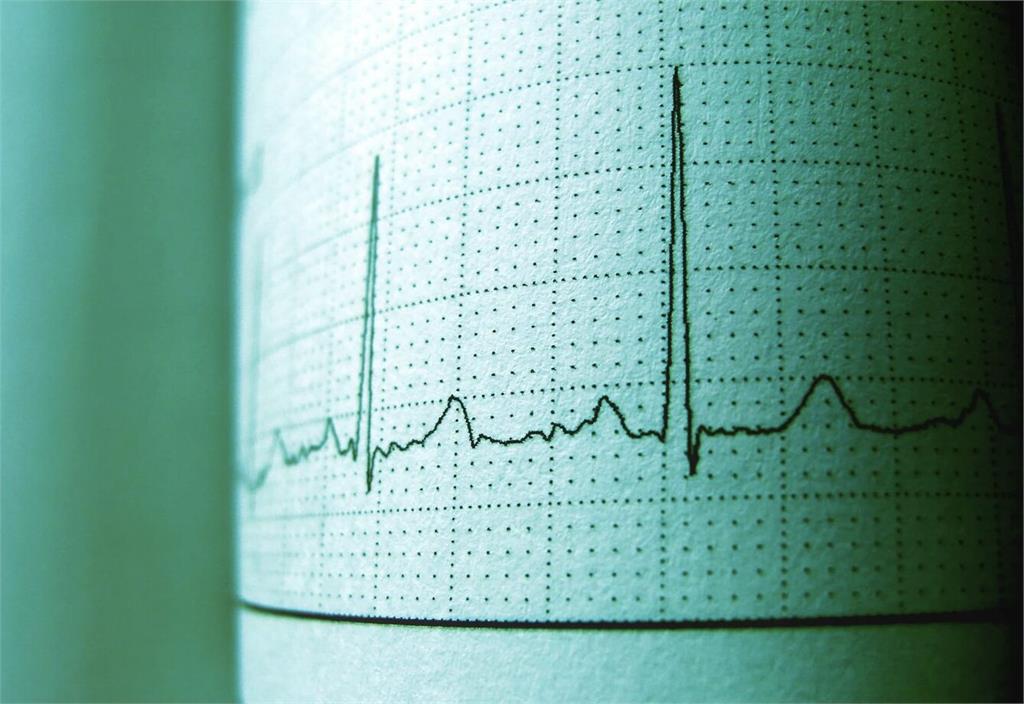 健壯導遊爬山「喘又心跳亂」   咖啡喝太多？其實已心房顫動