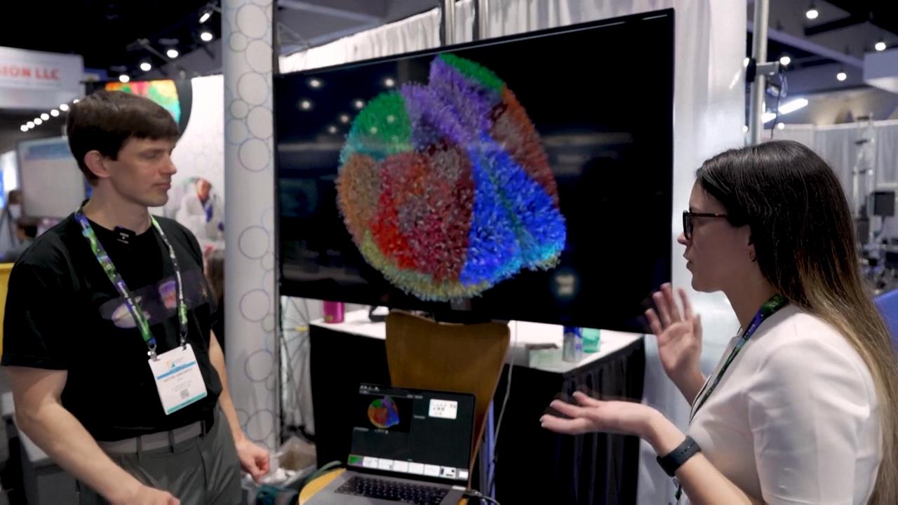 重大突破! 美科學家研發「小鼠大腦」 近千萬神經元打造 研究團隊首公開模型