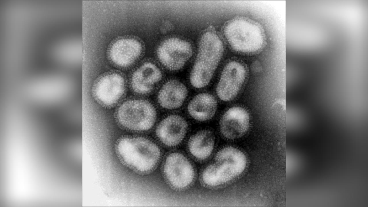 日本流感患者「單週增1.6倍」　厚生省批准公費疫苗提早打