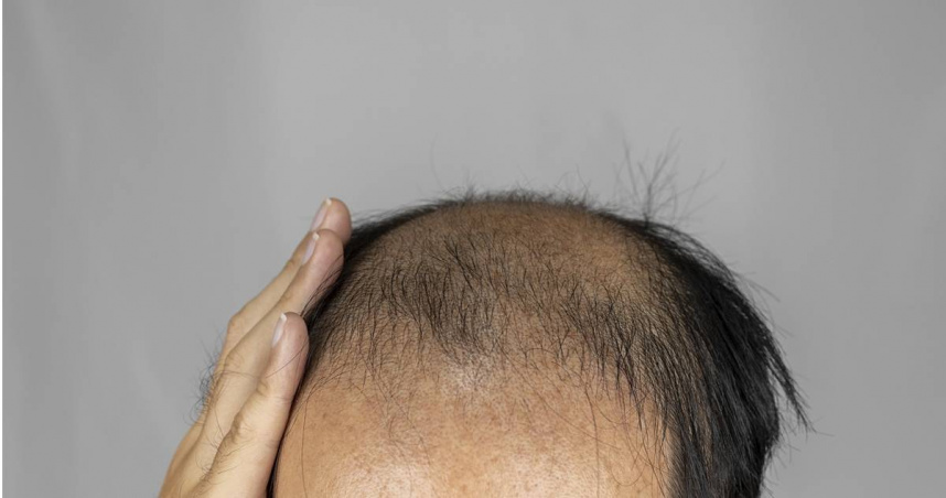 妹子和禿頭男約會2次！拒交往被要求費用AA　她傻眼：買單不是很正常？全場搖頭