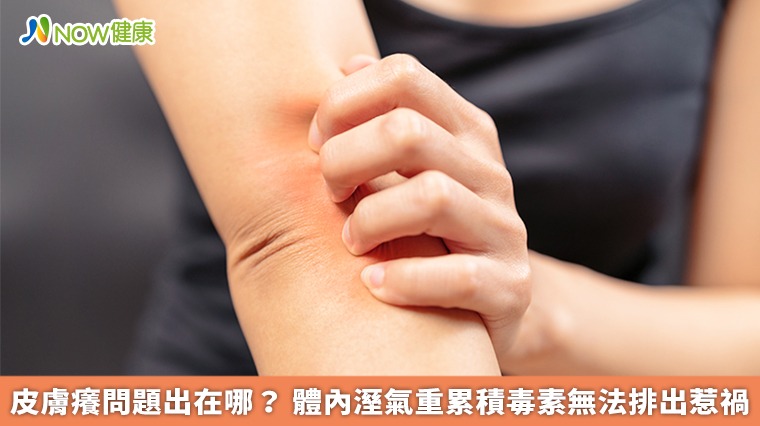 皮膚癢問題出在哪？體內溼氣重累積毒素無法排出惹禍