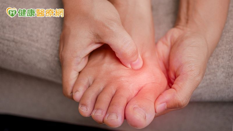 拇趾外翻愈來愈嚴重？醫師解析治療與改善方法