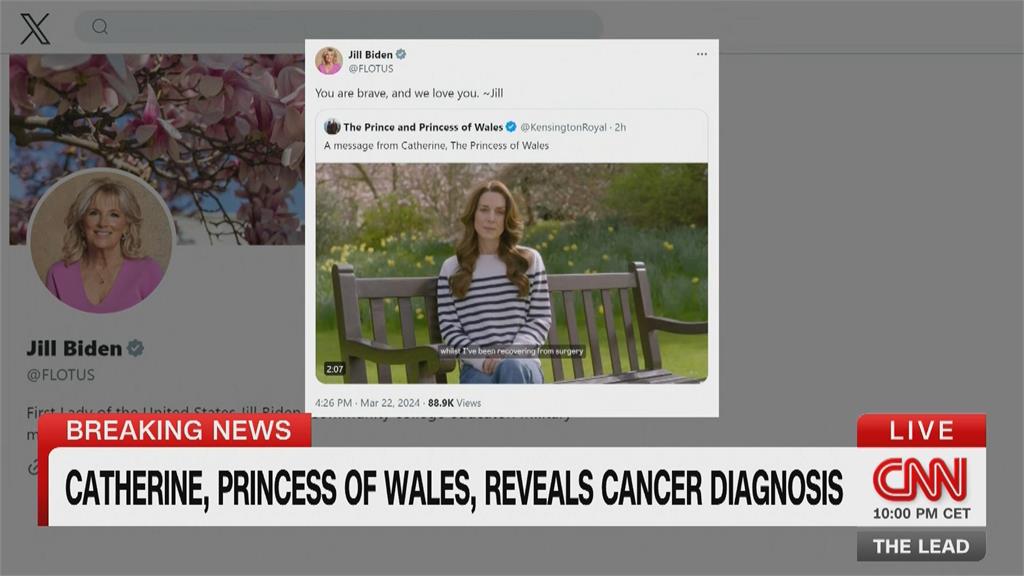 親自宣布罹癌震驚全球　凱特王妃新作風民眾讚賞
