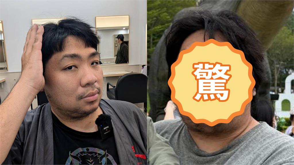 統神4個月暴增14kg「胖回118公斤」下顎線全無！今昔對比驚呆網：別再吃了