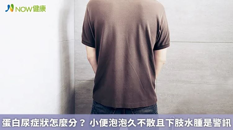 蛋白尿症狀怎麼分？ 小便泡泡久不散且下肢水腫是警訊