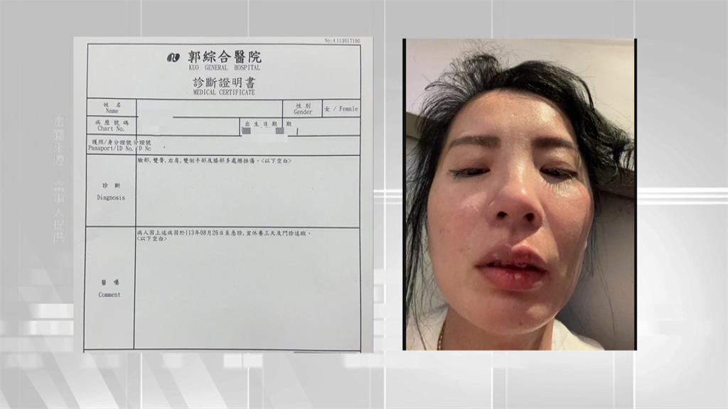 小野麗莎經紀人逛百貨踩空樓梯滿臉血　怒揭「危險設計」已提告