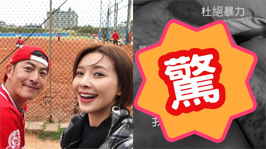 吳婉君「前夫」現身了！裸上空「公開傷痕照」砲這句疑偷臭趙駿亞