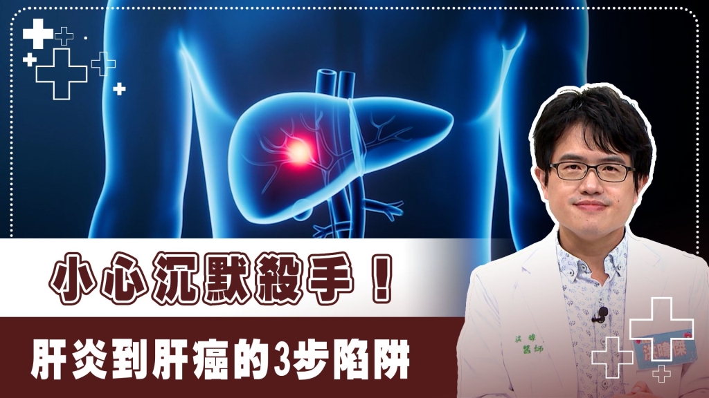 B肝罹癌機率飆高20倍!醫揭「慢性發炎路徑」:纖維化、肝硬化、肝癌