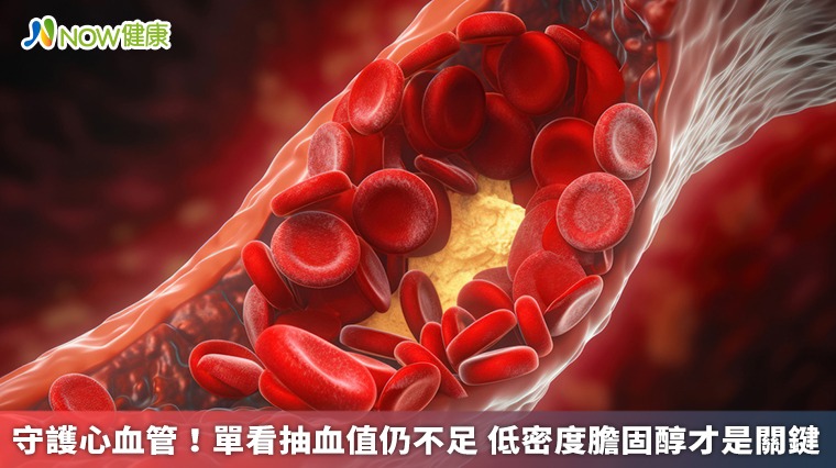 守護心血管！單看抽血值仍不足 低密度膽固醇才是關鍵