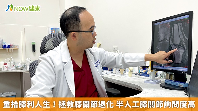 重拾膝利人生！拯救膝關節退化 半人工膝關節詢問度高