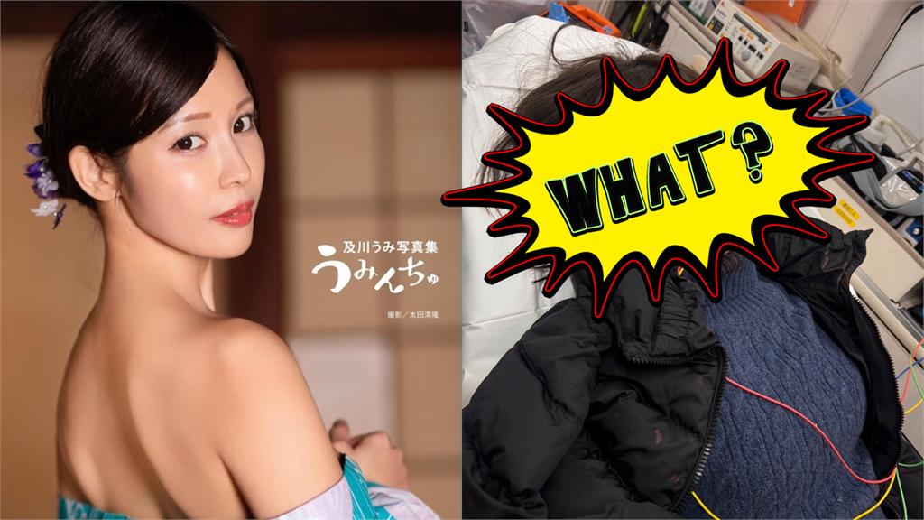 日本「暗黑界女神」驚爆毀容！「臉縫13針」傷勢照曝…坦言：沒把握能復原