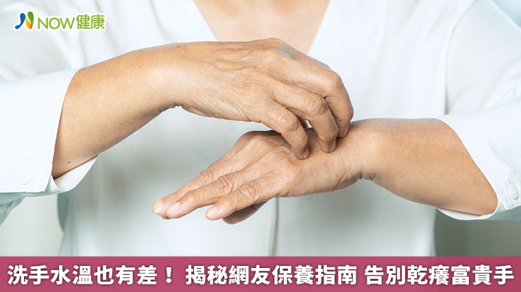 洗手水溫真的有差！揭秘網友保養指南　告別乾癢富貴手