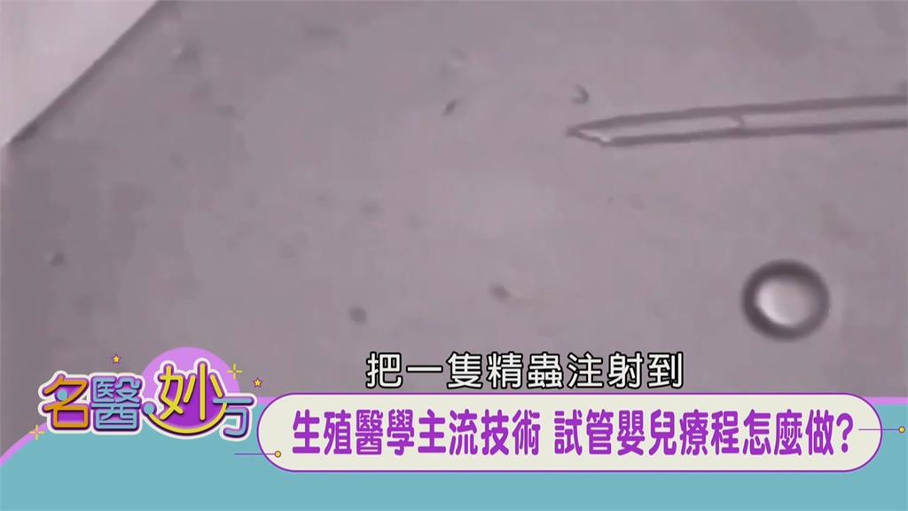 「人工受精」兩類人做不會成功!輸卵管兩側阻塞女性!精子量不夠男性!