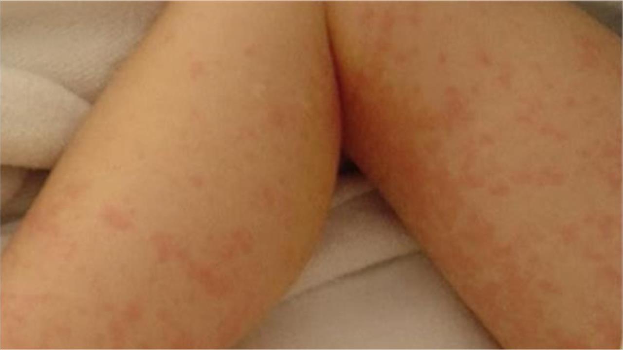 19歲男「爽吃超嫩姊妹花」邀她激戰10次！雙雙中招「染梅毒」媽崩潰了