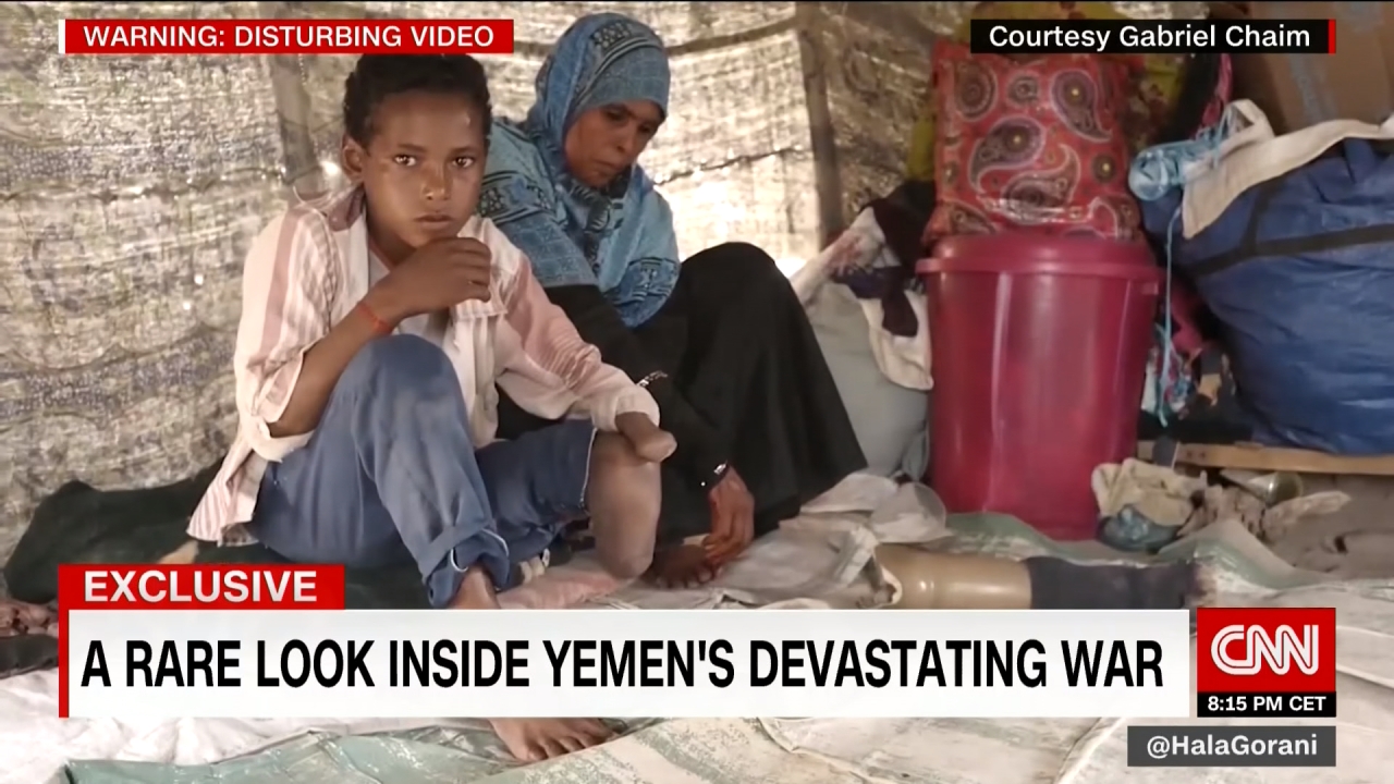 政府軍叛軍激戰 葉門人民飽受戰火摧殘