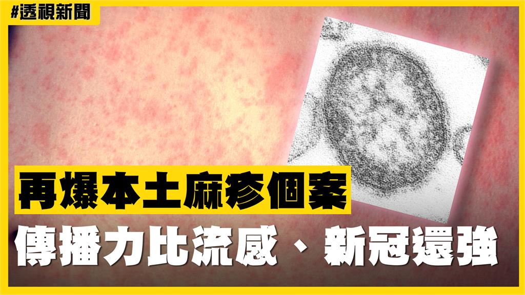 透視新聞／再爆本土麻疹個案　傳播力比流感、新冠還強