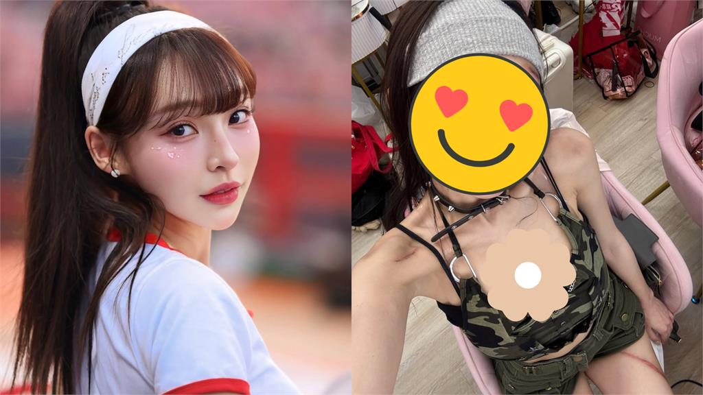 林襄變「重傷版女神」臉傷腿裂畫面流出 網看傻:以為出事了