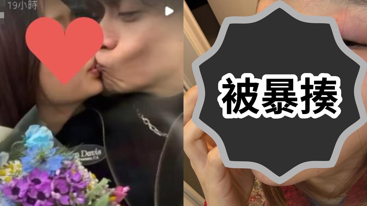 小三畫家控遭Ryu「毆打、掐脖」傷痕照曝光！他不忍反嗆：酒瓶砸我脖子上