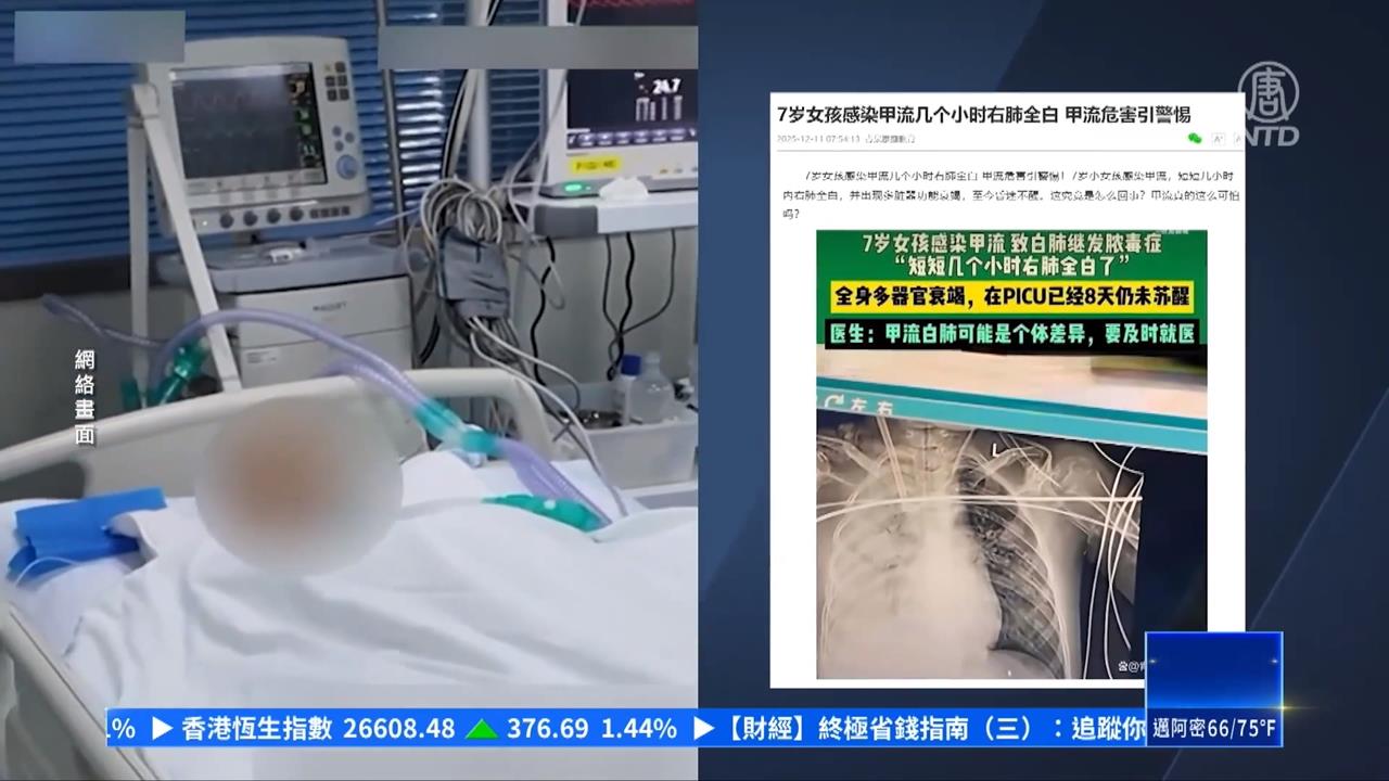 中國多種呼吸道病毒流行　鼻病毒大爆發、A型流感盛行