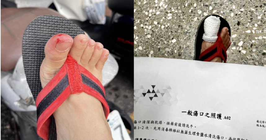 女子愛逛歸仁黃昏市場！遇「鼠咬人」腳趾血流如注　仍喊：下次要穿布鞋來