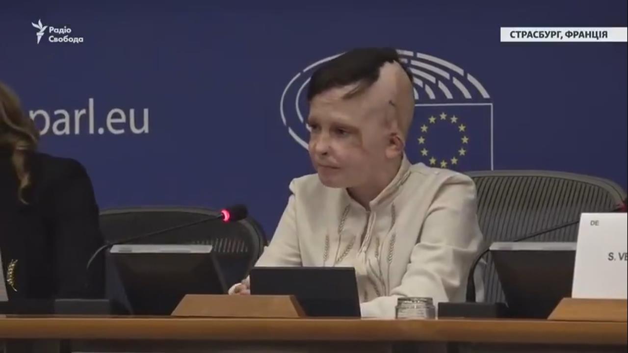 烏克蘭男童歐洲議會演說「與母永別」　口譯員淚崩哽咽到說不出話