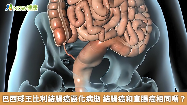 巴西球王比利結腸癌惡化病逝　結腸癌和直腸癌相同嗎？