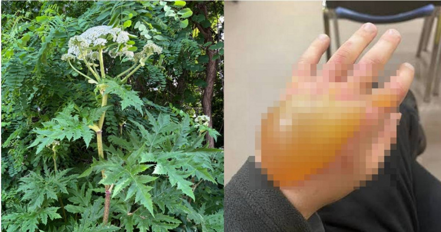 日本北海道驚見「世界第一猛毒植物」　誤觸慘況曝！嚴重恐失明