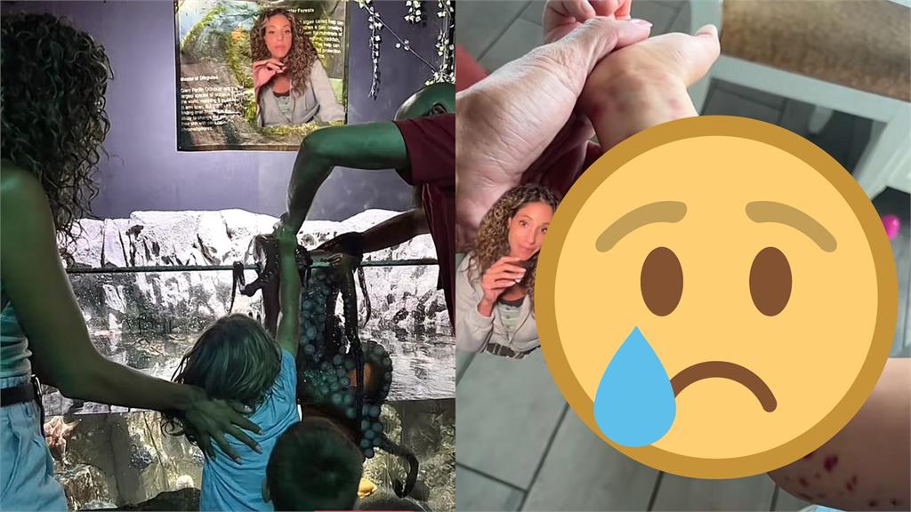 6歲男童遭章魚「纏手不放」　6大人掰8隻腳手臂全是紫色吸盤印