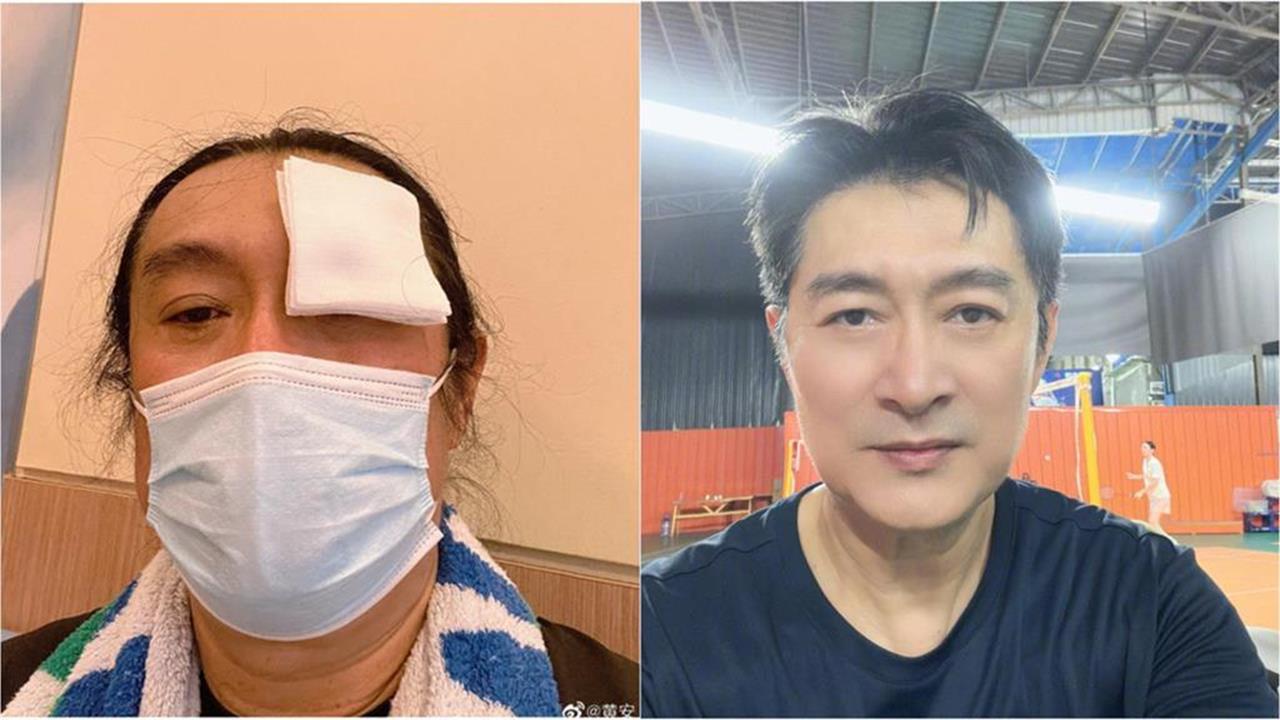 黃安爆「剛搬到中國福州」第1年瞎了!身體接連出狀況「全靠超玄1招」挺過