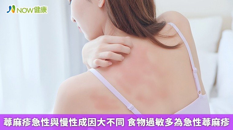 蕁麻疹急性與慢性成因大不同 食物過敏多為急性蕁麻疹