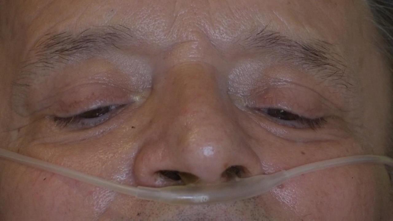 法國通過「協助死亡」法案　條件嚴格且須滿18歲