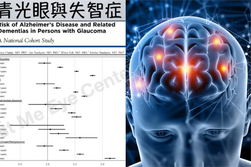 青光眼竟和「失智症」有關聯 醫籲「這年齡」患者進行心智評估