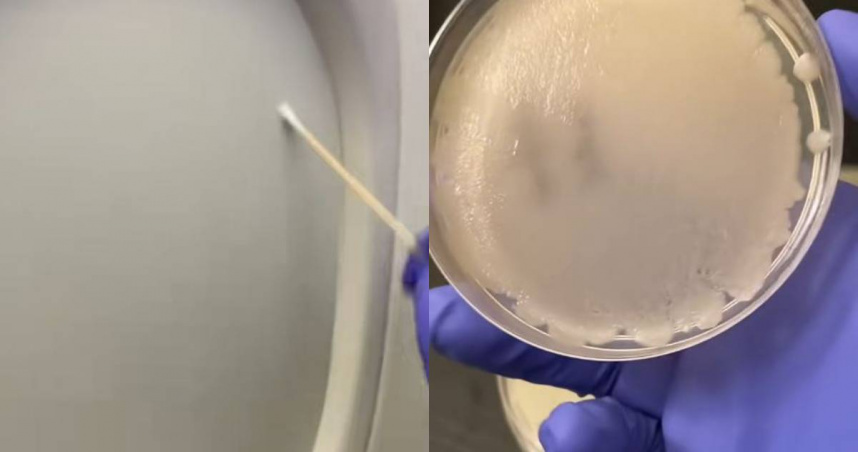 搭飛機最好穿長袖! 專家取樣4處送實驗室「長出整片細菌」