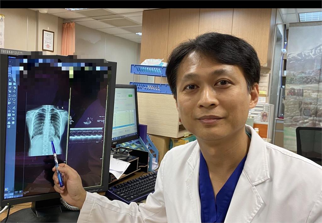 不喘不胸悶   26歲女拍個X光片驚見「心臟衰竭」險快猝死