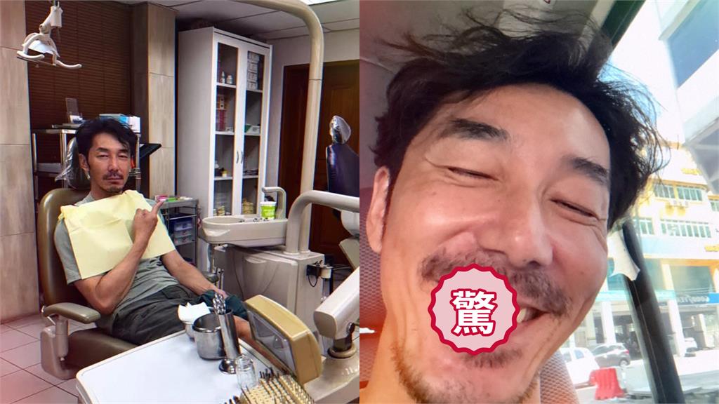 李李仁入境馬來西亞「遭扣留2小時」連牙齒也掉了！他親揭悲慘現況