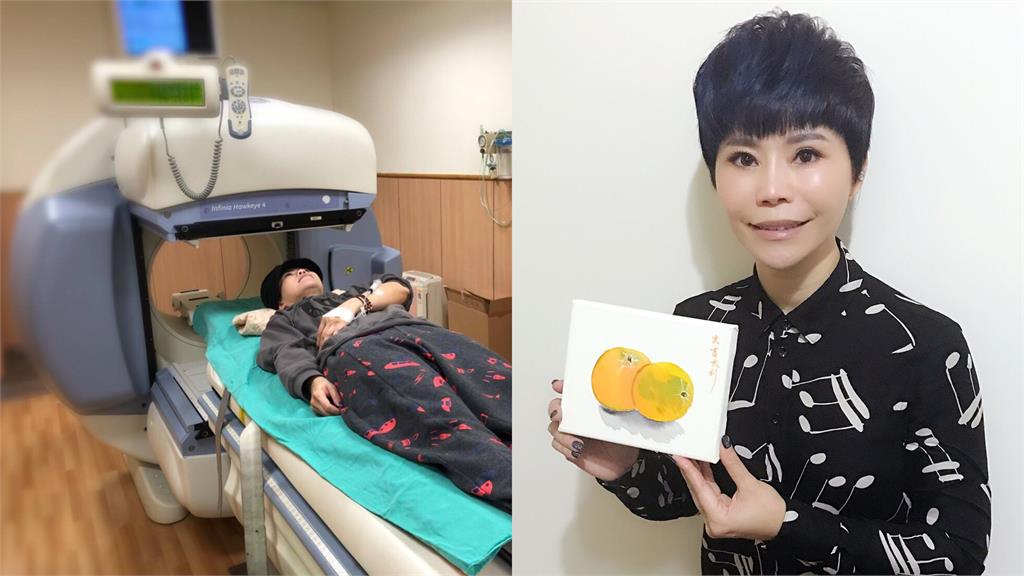 詹雅雯還要動開腦手術！聽到「媽媽1句話」愧疚流淚：我會再勇敢一點