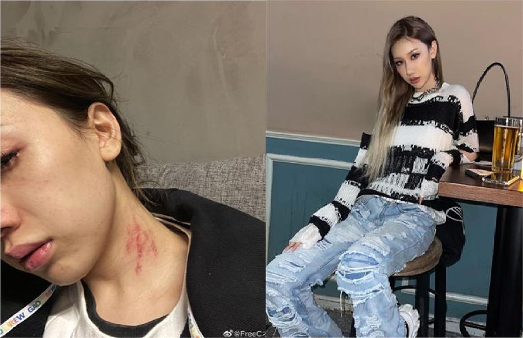 快新聞/又見家暴!女歌手淚訴遭男友打「脖子被抓出血痕」 嘆:總在玻璃碎中找糖吃