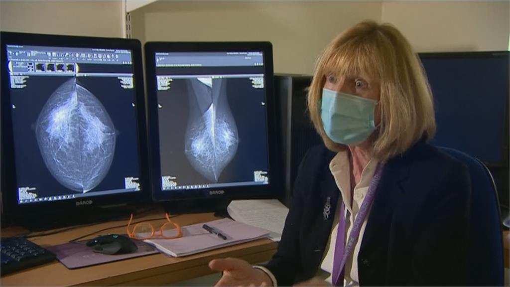 口水測罹患乳癌風險　英國知名醫學院參與試驗