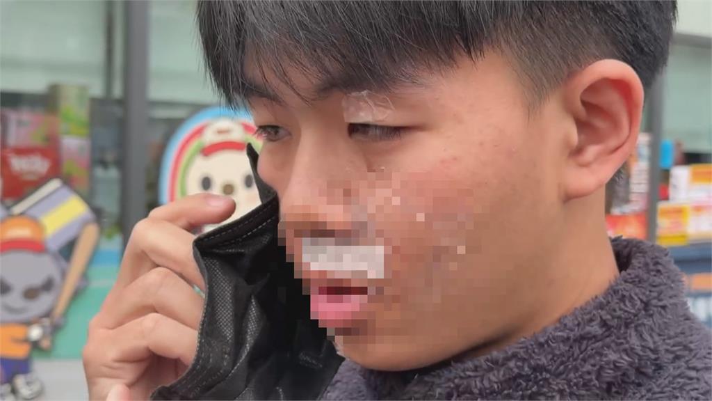 騎車逆向撞人爆口角　騎士毆打7旬翁.勸架大學生